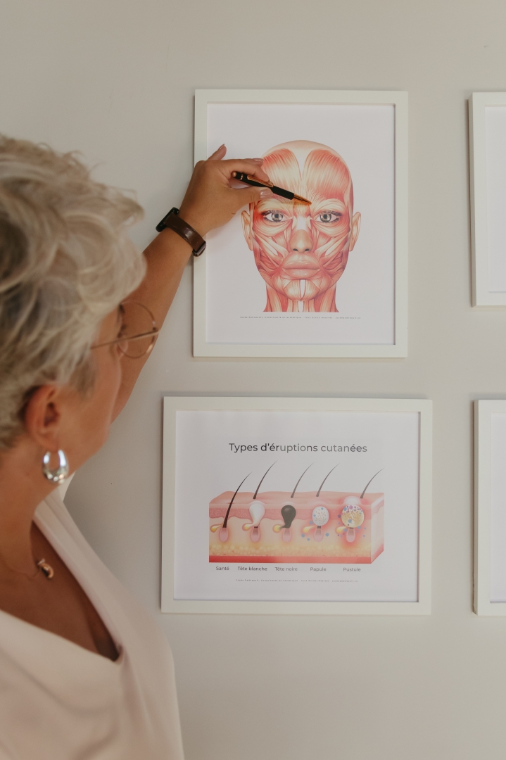 Forfait - Le Mur de consultation