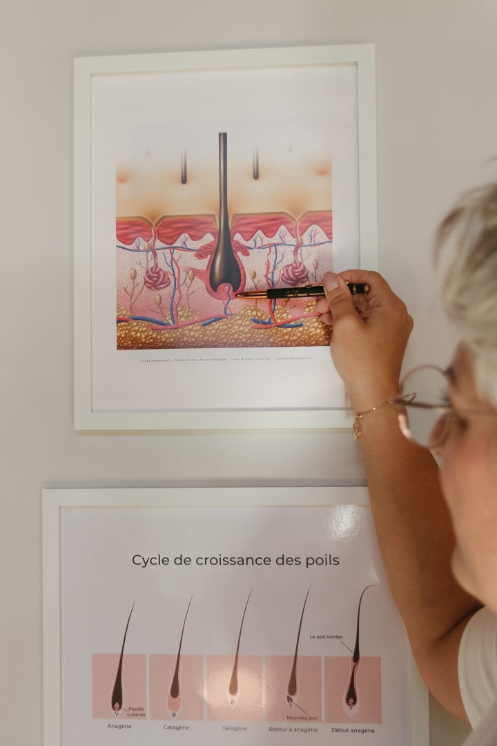 Forfait - Le Mur de consultation